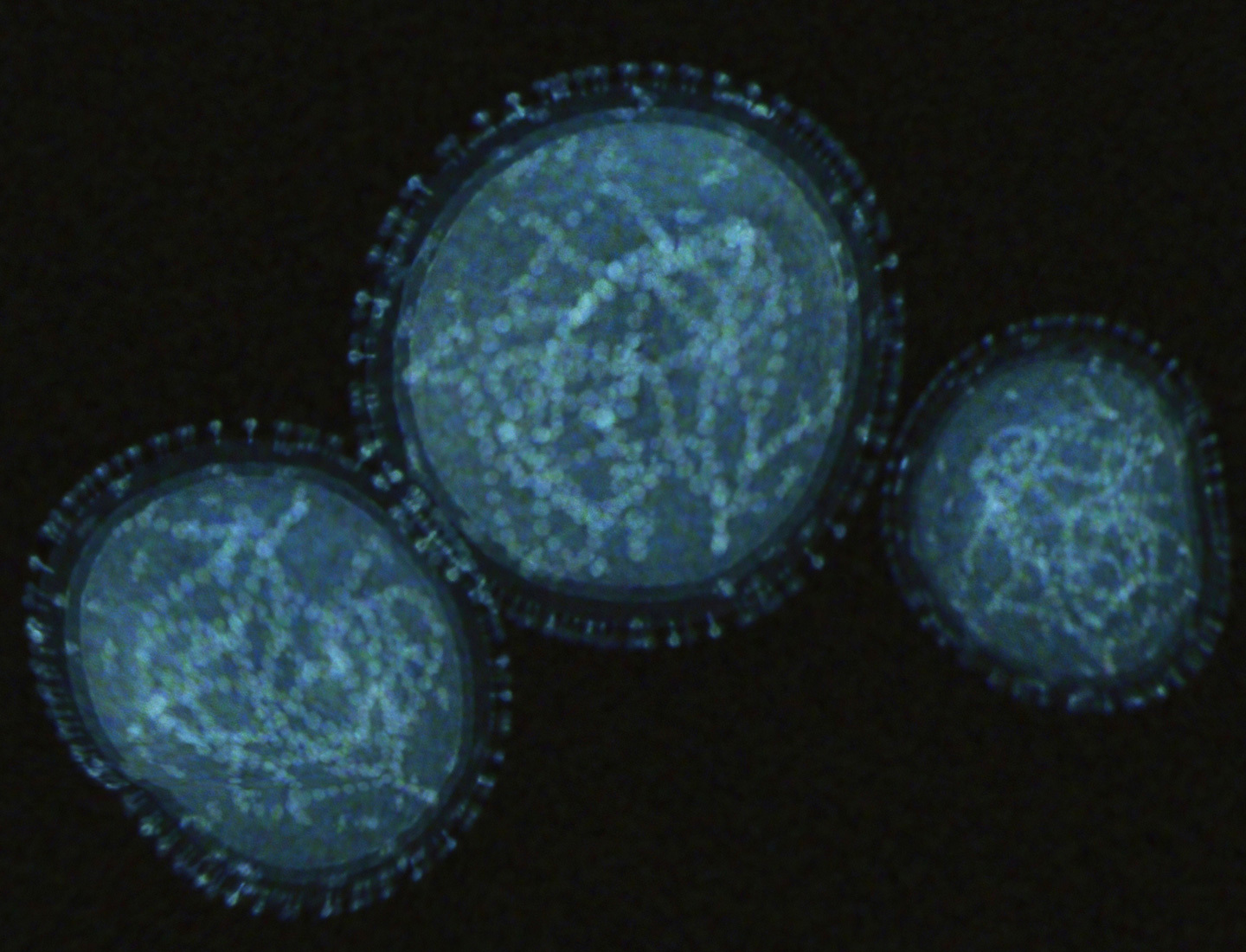 An actual image of the monkeypox virus is shown against a black background. The virus is blue and circular, with the spike protein surrounding it.