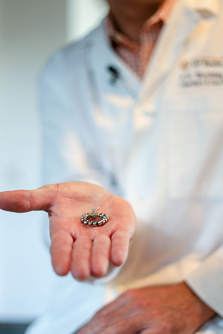 F. P. “Tripp” Buckley III, MD, who serves as the Surgical Director of Digestive Health, a clinical partnership between UT Health Austin and Ascension Seton, holds an implant device used in the LINX procedure.