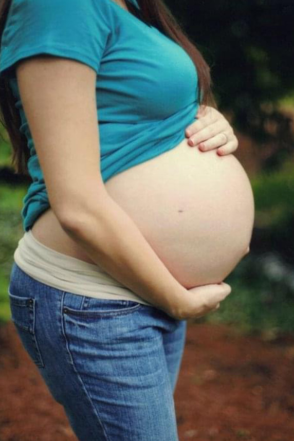 Amber Cessac shows her in-utero surgery scar on her pregnant belly.