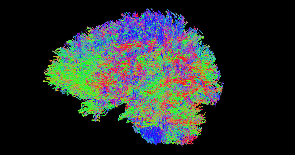 Color-coded brain scan showing neural pathways using diffusion tensor imaging tractography.