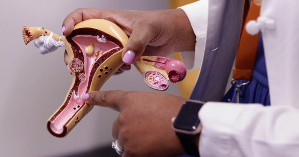 The hands of M. Yvette Williams-Brown, MD, pointing to a model of the female reproductive system.