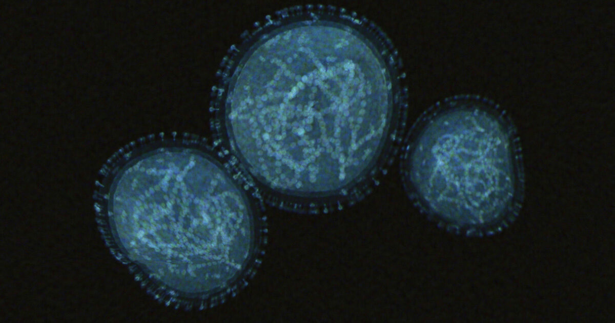 An actual image of the monkeypox virus is shown against a black background. The virus is blue and circular, with the spike protein surrounding it.