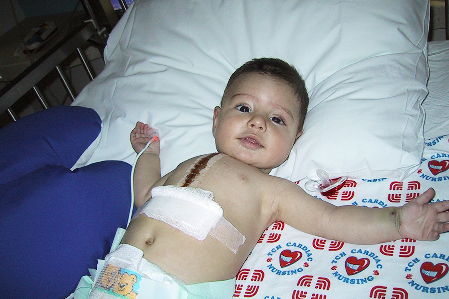 Infant Lorenzo lays on a hospital bed post cardiac surgery.